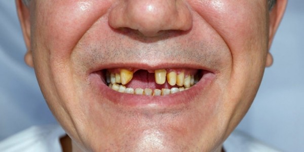 К чему снятся желтые зубы: трактовка известных сонников
