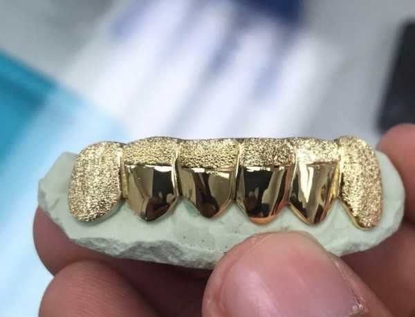 К чему снятся золотые зубы: толкование сонников