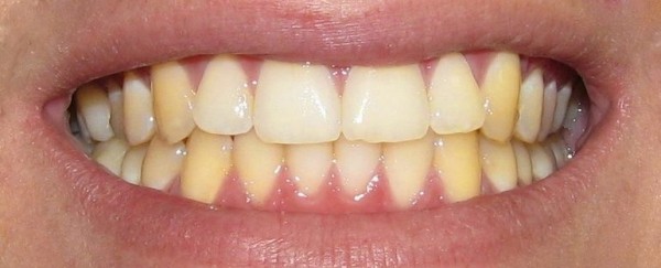 К чему снятся желтые зубы: трактовка известных сонников