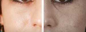 Серый цвет лица у женщин и мужчин: причины тусклой кожи, как вернуть здоровый румянец
