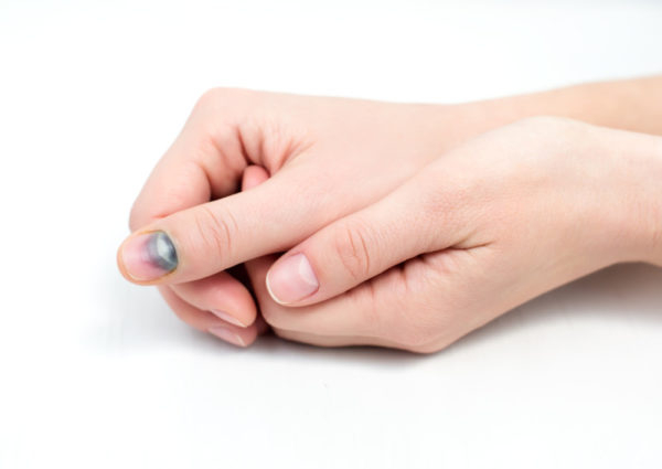 Возможные причины расслаивания ногтей у ребенка на руках и методы укрепления ногтевой пластины